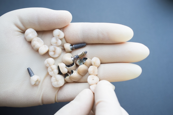 Care For Your Smile: 5 Maintenance Tips for Dental Implants
